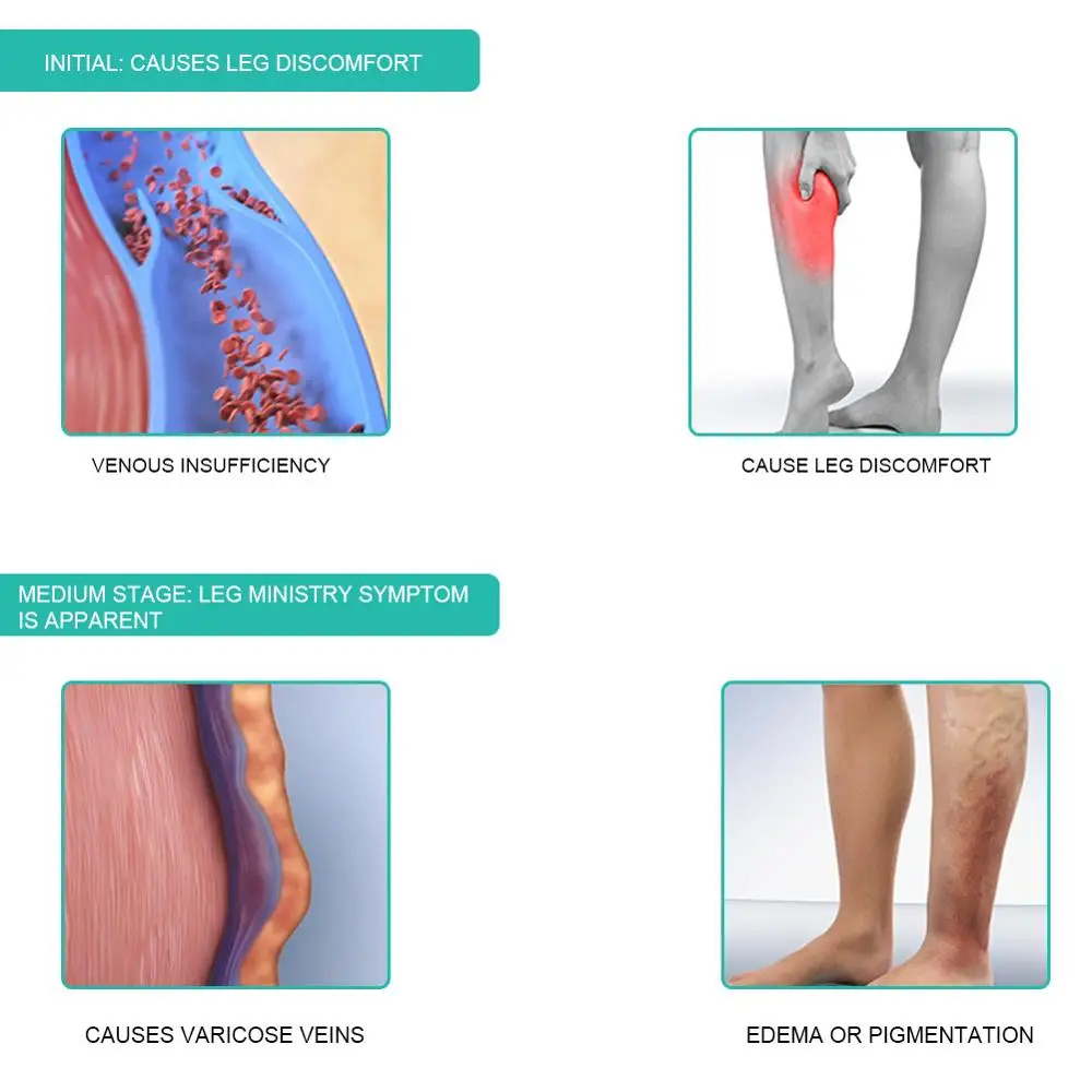 1Pair Medical Compression Sock - Compression Sock Medical recension och pris
